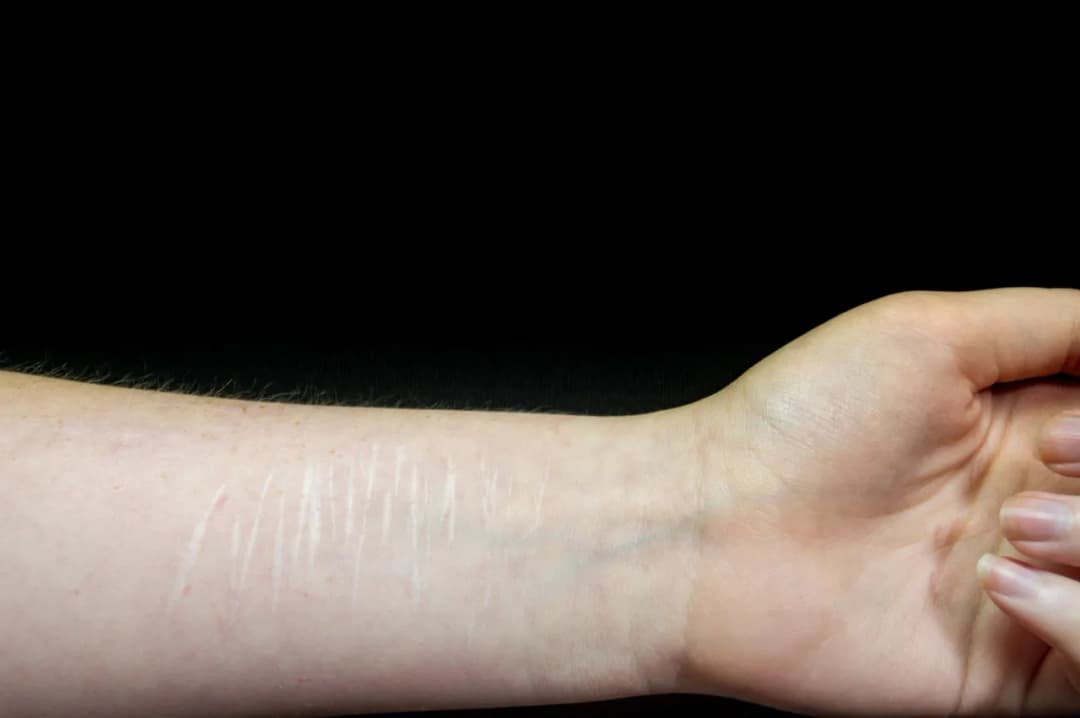 Czy samookaleczanie to grzech ciężki? Perspektywa religijna