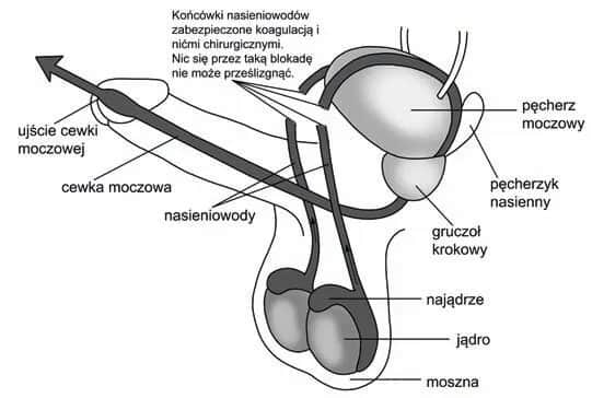 Czy wazektomia to grzech? Moralne i religijne aspekty zabiegu