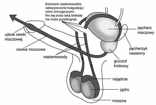 Czy wazektomia to grzech? Moralne i religijne aspekty zabiegu